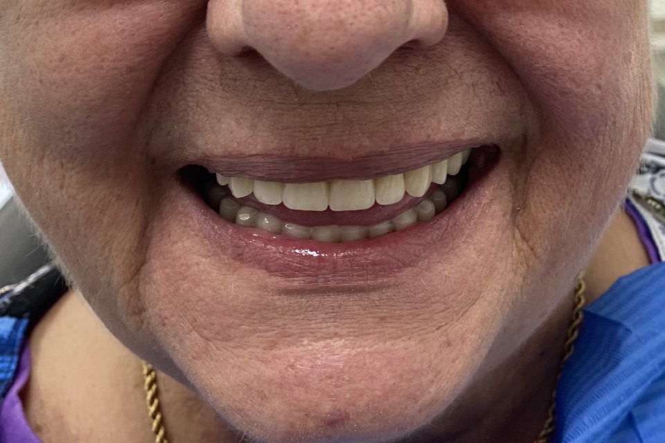 Persona mayor sonríe