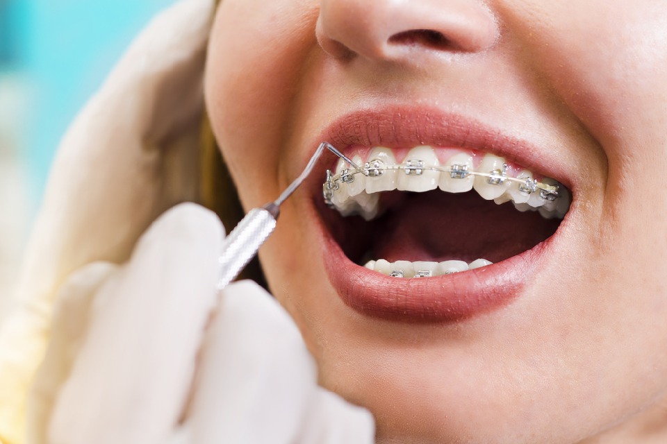 Dentista revisando la ortodoncia de una chica